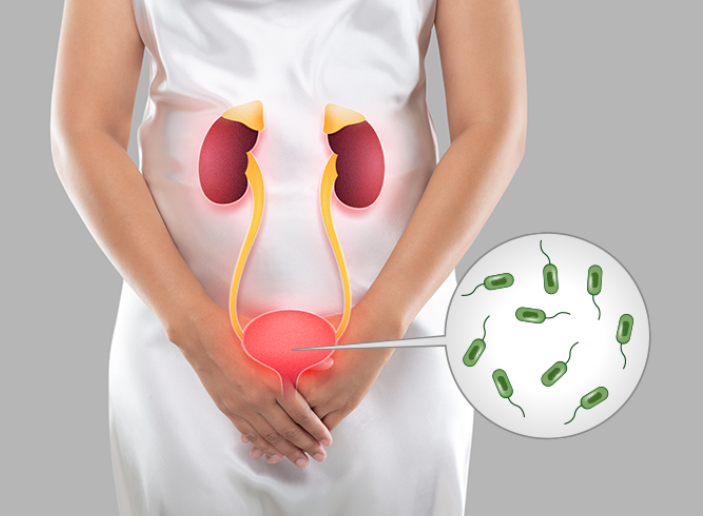 Urine Infection Natural Remedies